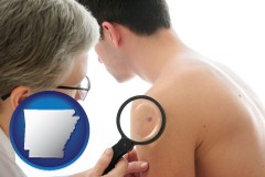 arkansas map icon and a dermatologist examines a mole on a male patient