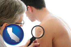 california map icon and a dermatologist examines a mole on a male patient
