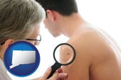 connecticut map icon and a dermatologist examines a mole on a male patient