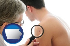 iowa map icon and a dermatologist examines a mole on a male patient