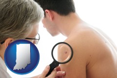 indiana map icon and a dermatologist examines a mole on a male patient