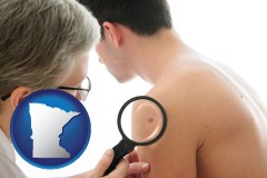 minnesota map icon and a dermatologist examines a mole on a male patient
