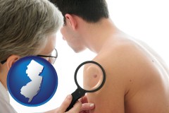 new-jersey map icon and a dermatologist examines a mole on a male patient
