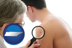 tennessee map icon and a dermatologist examines a mole on a male patient