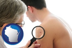 wisconsin map icon and a dermatologist examines a mole on a male patient