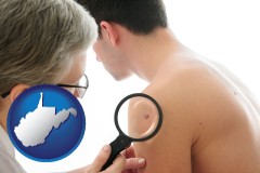 wv map icon and a dermatologist examines a mole on a male patient