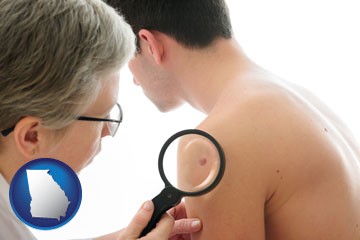 a dermatologist examines a mole on a male patient - with Georgia icon