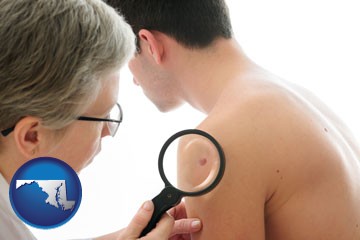 a dermatologist examines a mole on a male patient - with Maryland icon