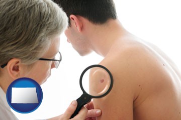 a dermatologist examines a mole on a male patient - with North Dakota icon