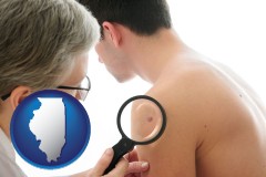 a dermatologist examines a mole on a male patient - with IL icon