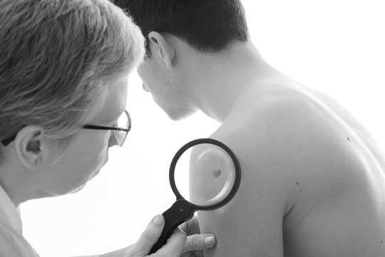 a dermatologist examines a mole on a male patient